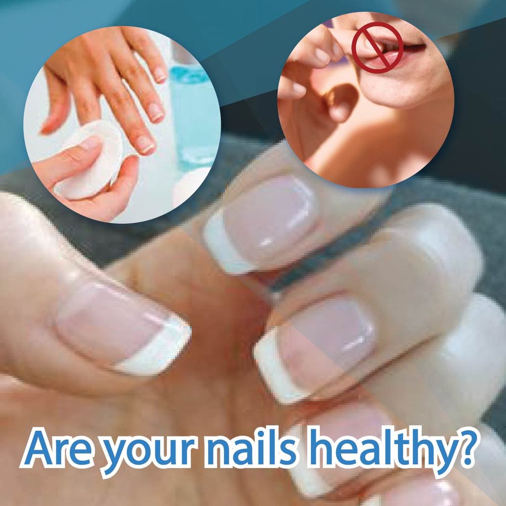 Are your nails healthy?